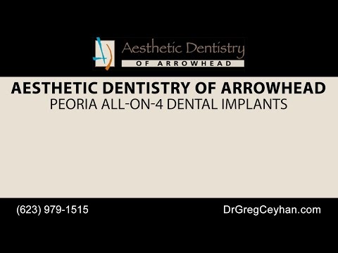 Peoria All-On-4 Dental Implants | Aesthetic Dentistry of Arrowhead