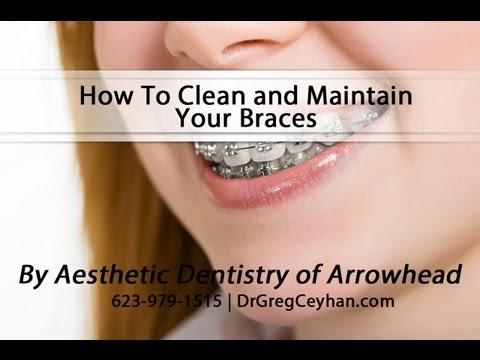 How To Clean and Maintain Your Braces | Aesthetic Dentistry of Arrowhead