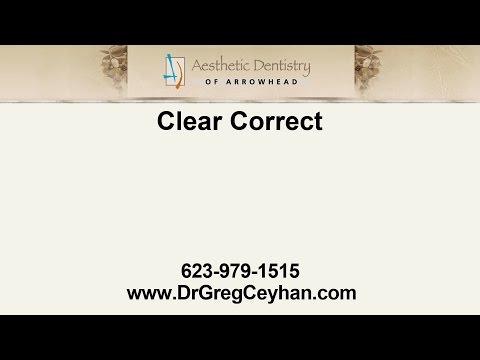 Straighten Your Teeth With Glendale ClearCorrect | Aesthetic Dentistry of Arrowhead