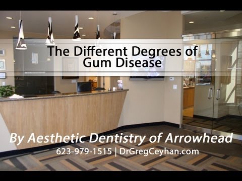 The Different Degrees of Gum Disease | Aesthetic Dentistry of Arrowhead