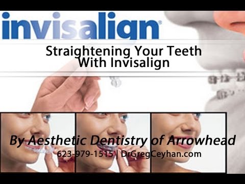 Straightening Your Teeth With Invisalign | Aesthetic Dentistry of Arrowhead