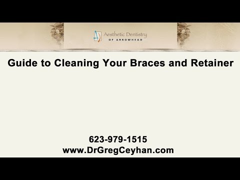 Guide To Cleaning Your Braces &amp; Retainer By Our Glendale Dentist