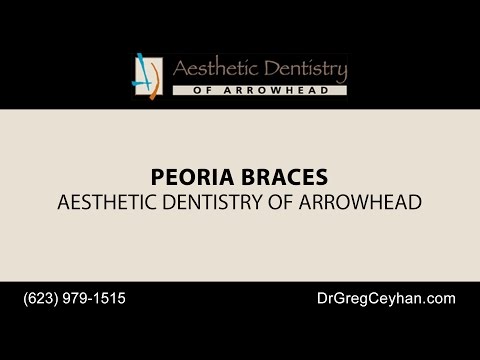 Peoria Braces | Aesthetic Dentistry of Arrowhead