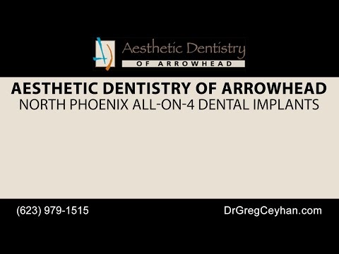 North Phoenix All-On-4 Dental Implants | Aesthetic Dentistry of Arrowhead