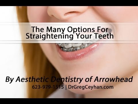 The Many Options For Straightening Your Teeth | Aesthetic Dentistry of Arrowhead