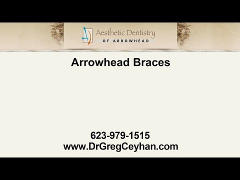 Arrowhead Braces | Aesthetic Dentistry of Arrowhead