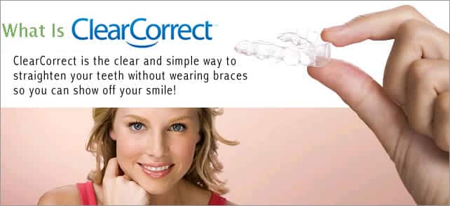 ClearCorrect Braces In Arrowhead