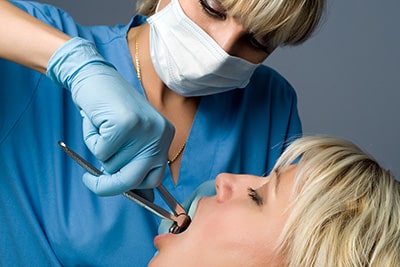 Tooth Extractions